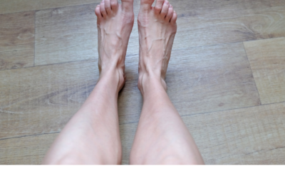 Did You Know Your Feet Change in Menopause?
